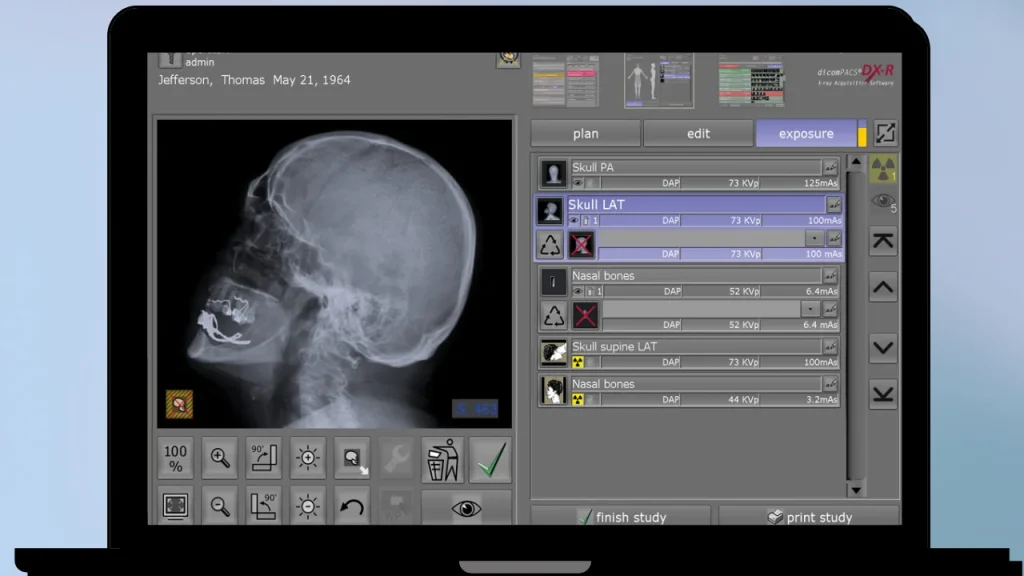Disk Xray Gratis Download Full Terbaru Version Poratble And Multilingual