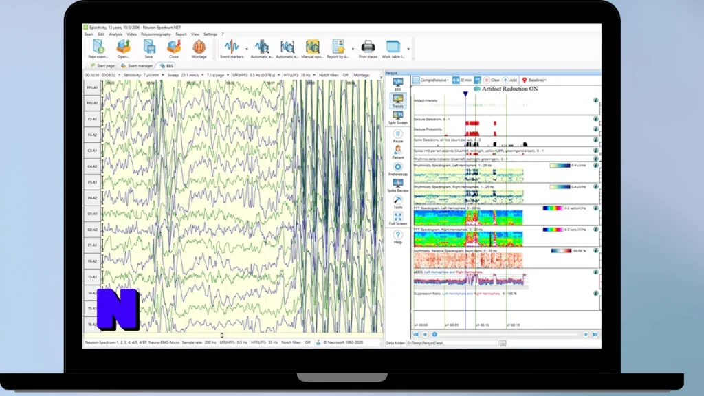 AIT Encevis Download Full Terbaru Version Poratble And Multilingual